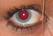 Un ojo rojo.